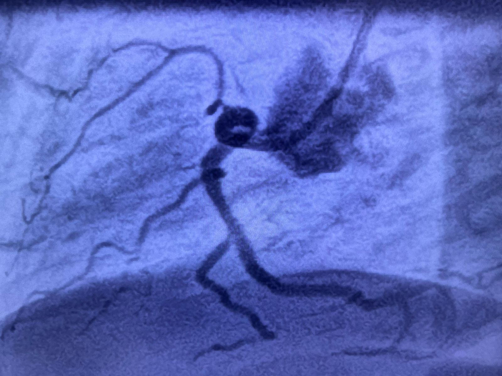 Medical Angiogram Image 6